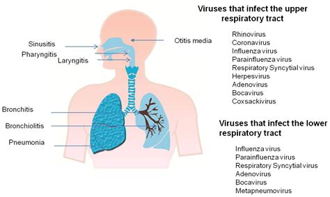  The common culprit is a viral infection of the lower respiratory tract, but bacteria such as Streptococcus and Bordetella bronchiseptica can also cause the disease