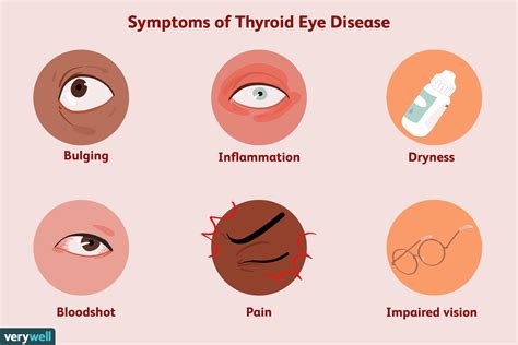  The common ones are hip dysplasia, reverse sneezing, thyroid issues, skin issues, heart disease, and eye problems