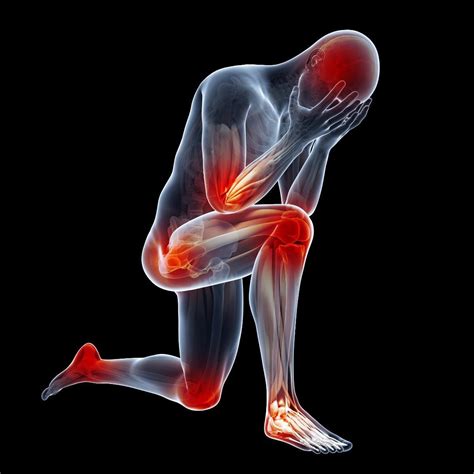  The inflamed joints can be extremely painful and sensitive to movement, triggering a pain response