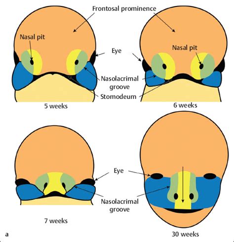  The internal changes which determine the external characters of this dog, consist in a great development of the frontal sinuses, a development which elevates the bones of the forehead above the nose, and draws the cerebral cavity in the same direction