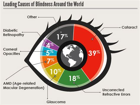  The lymphoma causes blindness if they are localized in the eyes