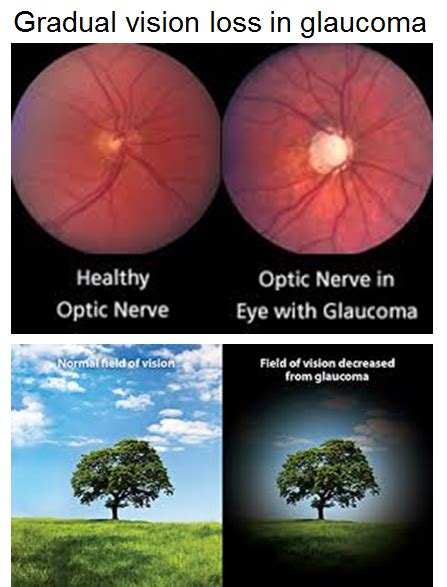  The major health concern is eye diseases: cataracts, glaucoma, retinal dysplasia, entropion, and others
