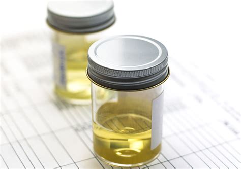  The product not only replicates the chemical composition and temperature of real urine but also prides itself on a meticulous quality control process that ensures accuracy and dependability