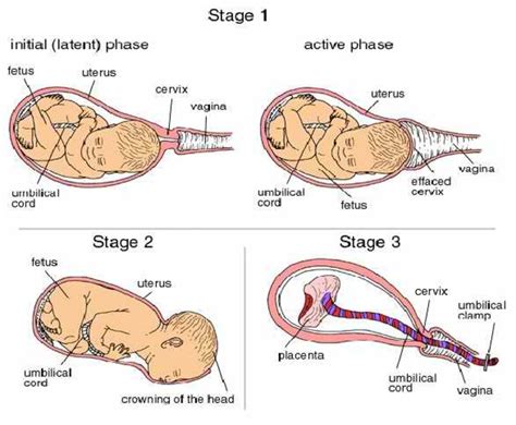 The third stage of labour is delivery of the foetal membranes and, in dogs, this stage can be concurrent with the second stage, as membranes are sometimes expelled with their puppy