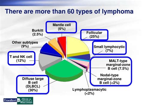  There are four types of lymphoma in order of prevalence : Multicentric systemic lymphoma is the most common form