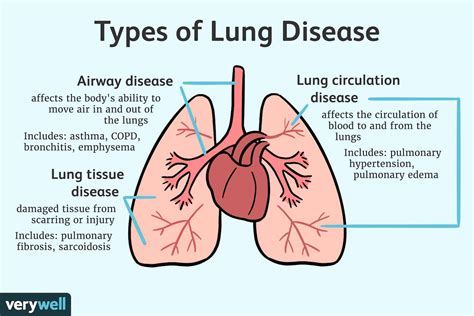  There are many kinds of lung disease