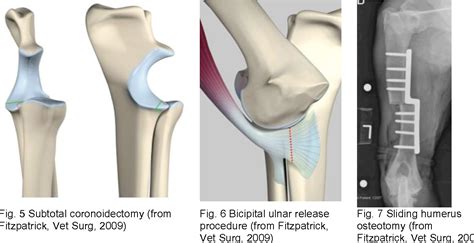  There are treatment options for hip and elbow dysplasia