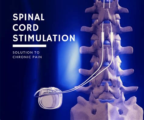  There is no treatment for the condition unless there is spinal cord pressure