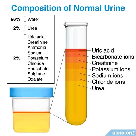  These are the primary components present in real urine