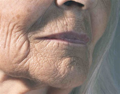  These facial wrinkles also feel as if …