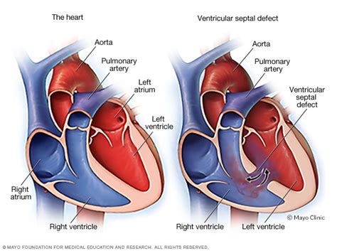  These include hip dysplasia, brachycephalic syndrome, and ventricular septal defect, where a hole develops in the heart