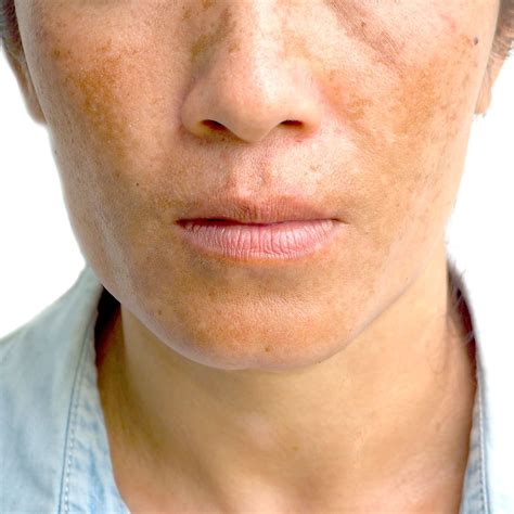  These tan markings are often found on the cheeks, above the eyes, on the sides of the chest, and the inner parts of the legs