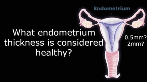 This causes severe stress to the uterine lining, and can lead to long term health issues