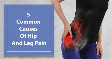  This health issue is usually caused by a malformation in the hip joint