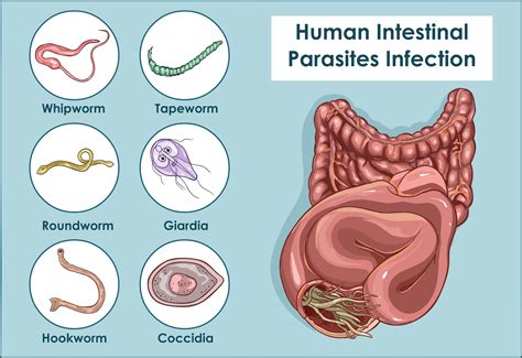  This means no intestinal parasites