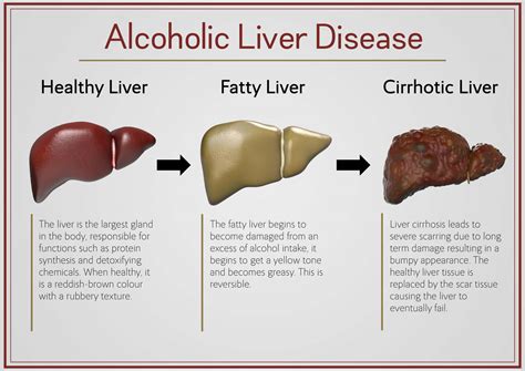  This means that alcohol tends to stay longer in the liver before getting metabolized
