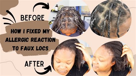  This method is very hard on the hair, and could result in scalp irritation, allergic reactions, and even hair loss
