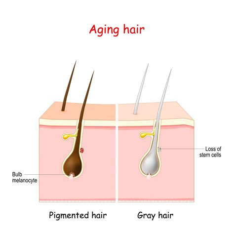  This mutation affects the melanin pigment in the hair follicles, resulting in a blue-gray appearance