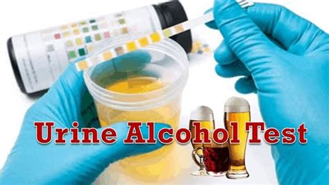  To learn more about alcohol urine tests and if you have a drinking problem and would like to enter into treatment, contact our team of substance abuse treatment specialists