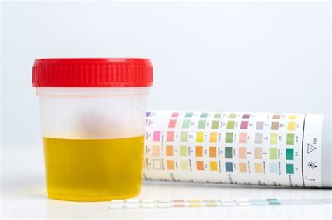  Too long an interval between urine tests can lead to unreliable results because most of the target drug and its metabolites will have been excreted