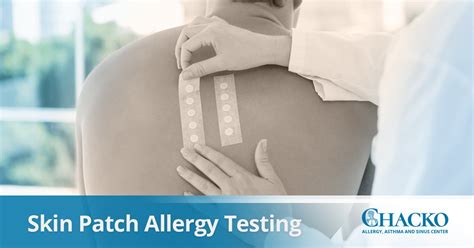  Typically, it requires a dermatologist to perform allergy testing to determine the cause of the dermatitis
