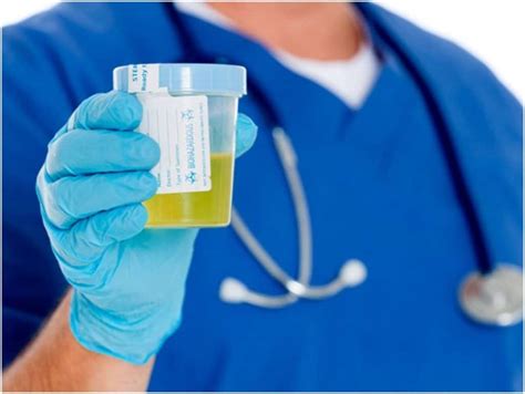  Urine drug tests are the most common type of test