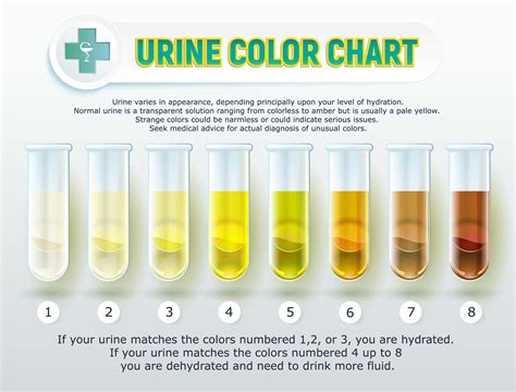 Urine is generally dark yellow, while diluted urine tends to be opaque or even transparent