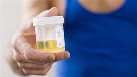  Urine samples are often temperature-tested to ensure sample integrity