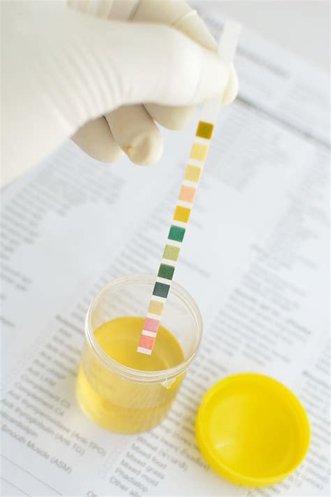  Urine screens are the most commonly used because they are relatively easy to obtain, contain a high concentration of drugs, provide a good analytical specimen, show recent use, are cost effective, and are a recognized method in court
