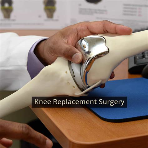  Usually surgical correction is done to stabilize the knee and help prevent crippling arthritis