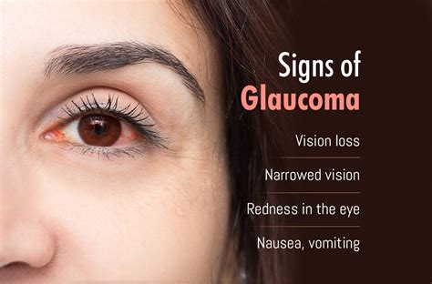  What are the main symptoms? Early detection of glaucoma is rare because the first and most important symptom is pain