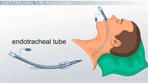  When recovering from anesthesia, if their endotracheal tube is removed too soon, they may not be awake enough to compensate for their airway issues when breathing