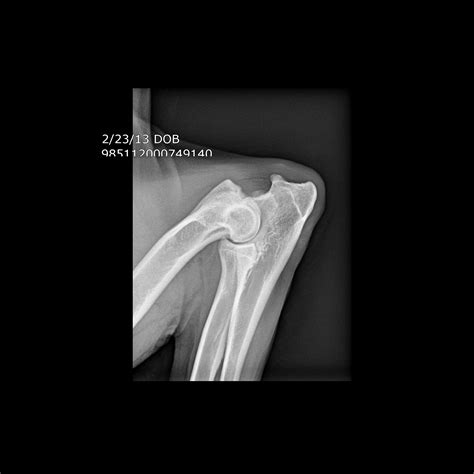  X-rays for hip and elbow dysplasia can be officially certified by the Orthopedic Foundation for Animals