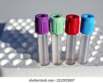 10,259 Blood Collection Tubes Images, Stock Photos & Vectors