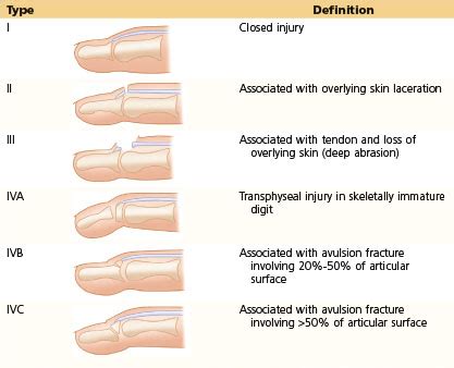 10: Extensor Tendon Repair in Zones 1 to 5 Clinical Gate