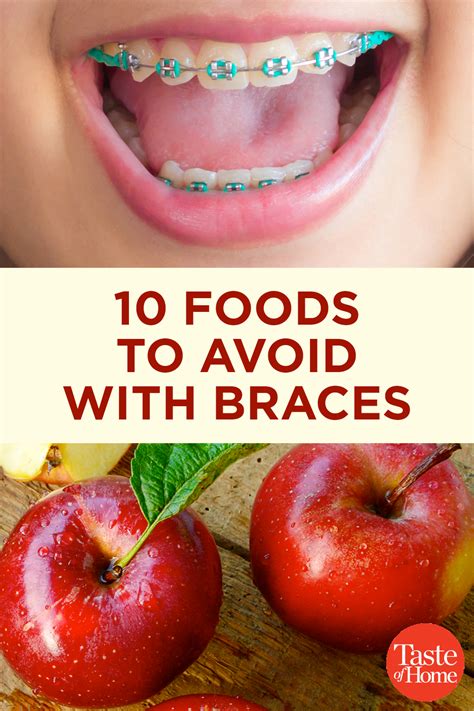 10 Foods to Avoid with Braces - Taste Of Home