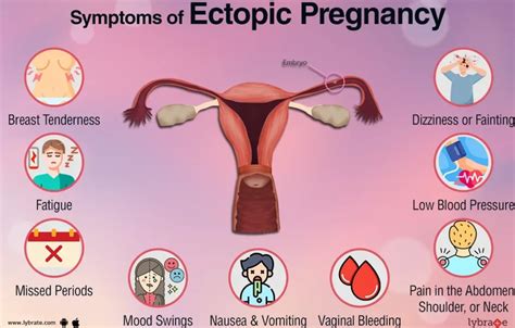 10 Signs and Symptoms of Ectopic Pregnancy