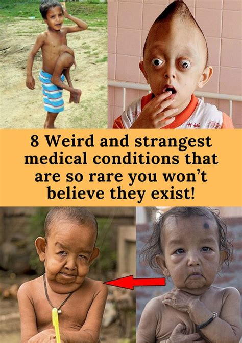 10 weird medical conditions that will shock you