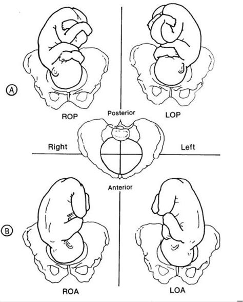 10.02 Key Terms Related to Fetal Positions Obstetric and …