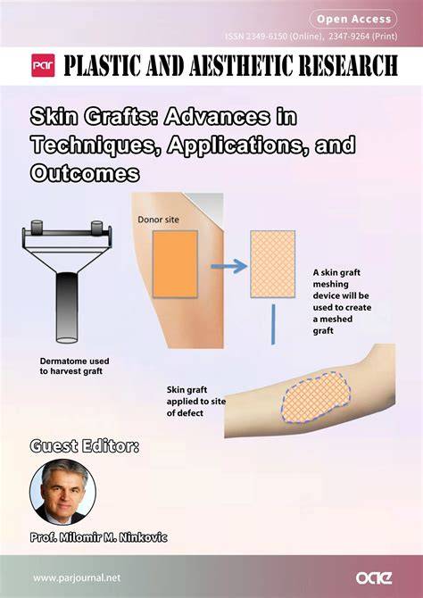 10.1: Grafts and Wounds - Biology LibreTexts - raincitystudios.com