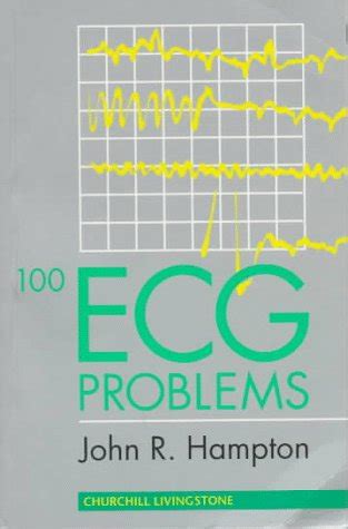 100 ECG Problems