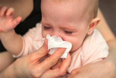 10个月宝宝感冒流鼻涕吃什么药