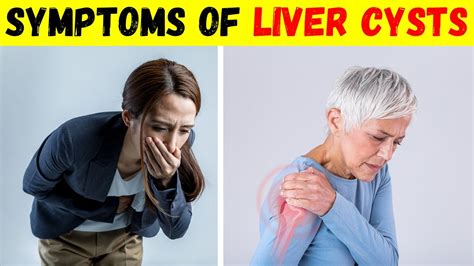 11 Symptoms of Liver Cysts and Pain-Causes and Treatment