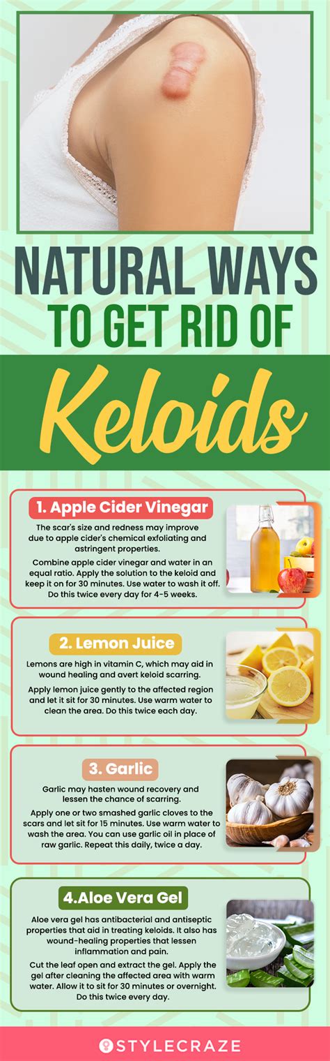 12 Home Remedies To Get Rid Of Keloids Naturally