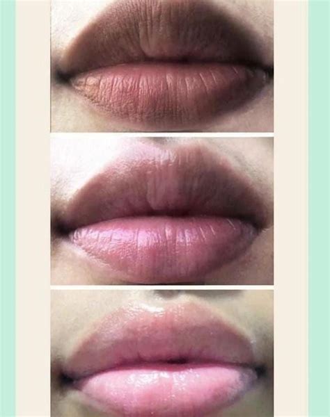 12 Cara Memerahkan Bibir Secara Alami Klikdokter Cara Memerahkan Bibir Secara Alami - Cara Memerahkan Bibir Secara Alami