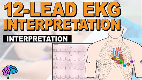Read 12 Lead Ecg Skill Lab 