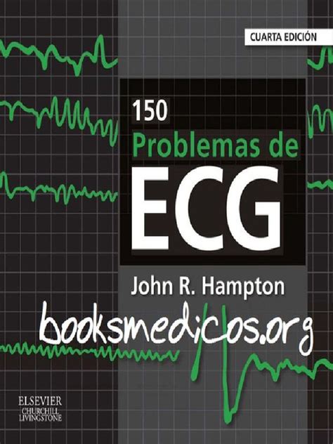 150 Problemas De Ecg