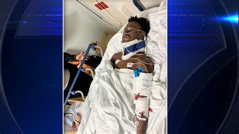 16-year-old boy injured in Hallandale Beach hit-and-run, mother speak out amid search for driver
