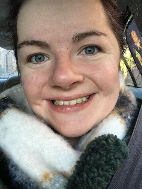 18 Braces Leaks [HD] 92 Videos