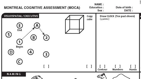 2 [PDF] PRINT MOCA EXAM FREE PRINTABLE DOWNLOAD DOCX ZIP ExamPrint